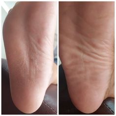 Heel Balm-Bálsamo para calcanhar